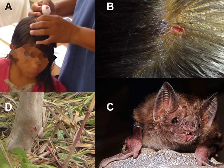 Bisse einer Vampirfledermaus